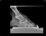 hoof x-ray with thnicker sole.jpg