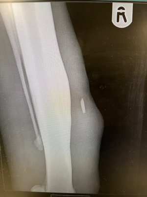 IMG_3872.jpeg IMG_3872.jpeg