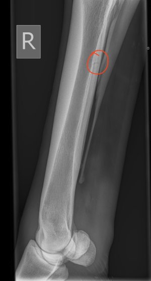 Wynn_Zara_81334_Hind Fetlock-Lateromedial Right-02_02_2026-09_54_24-62.jpeg