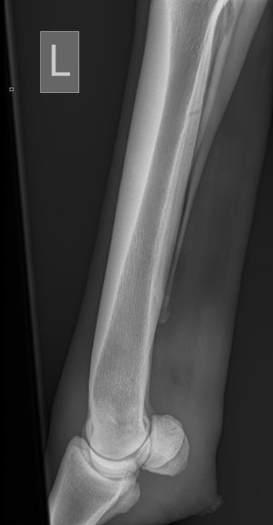 Wynn_Zara_81334_Hind Fetlock-Lateromedial Left-02_02_2026-09_54_31-333.jpeg