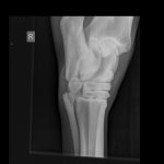 Broadbent_Duke_117849_TARSUS (Hock)-DLPMO-30_04_2021-18_37_16-155.JPEG