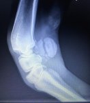 Screenshot_20220411-182649_Gallery.jpg Screenshot_20220411-182649_Gallery.jpg